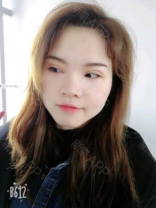 成都春天医学美容诊所是正规医院吗？