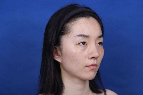 成都春天医学美容诊所收费价格表/收费标准