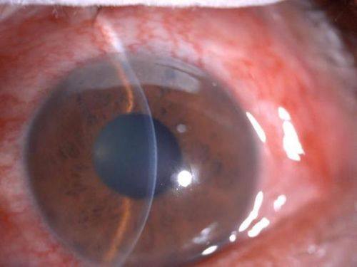 安徽芜湖爱尔眼科医院特色项目及技术优势