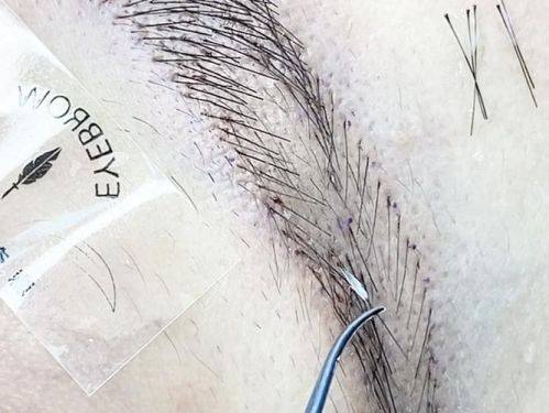 郑州碧莲盛医疗美容诊所收费价格表/收费标准