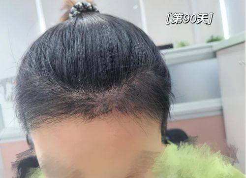 郑州碧莲盛医疗美容诊所地址电话营业时间