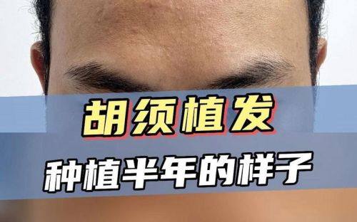 郑州碧莲盛医疗美容诊所真人口碑评价怎么样？