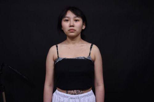 成都春天医学美容诊所特色项目及技术优势