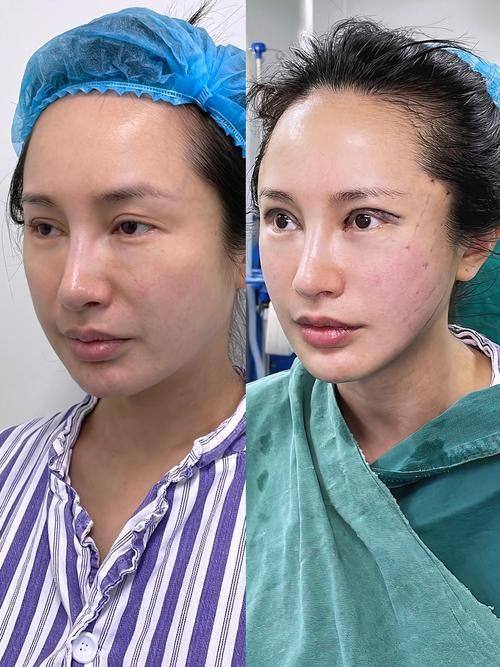 绍兴红曼薇整形医院真人口碑评价怎么样？