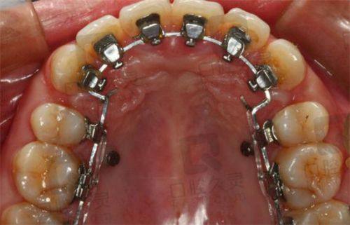 呼伦贝尔牙克石唯维口腔门诊部真人口碑评价怎么样?