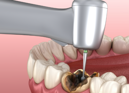 湖南郴州区晓征口腔地址电话营业时间