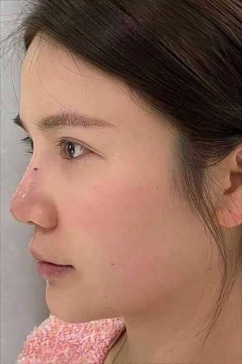 太原美然医疗美容门诊部特色项目及技术优势