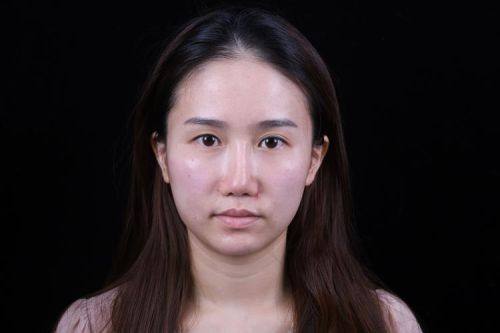 东莞环球美天整形医院详细的预约挂号方式及流程