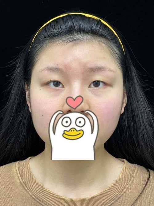 太原美然医疗美容门诊部详细的预约挂号方式及流程