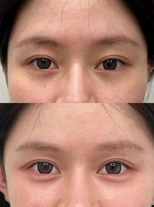 东莞环球美天整形医院收费价格表/收费标准