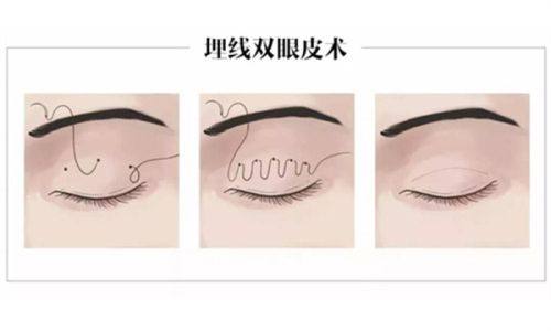 沈阳汇禾医疗美容门诊部收费价格表/收费标准