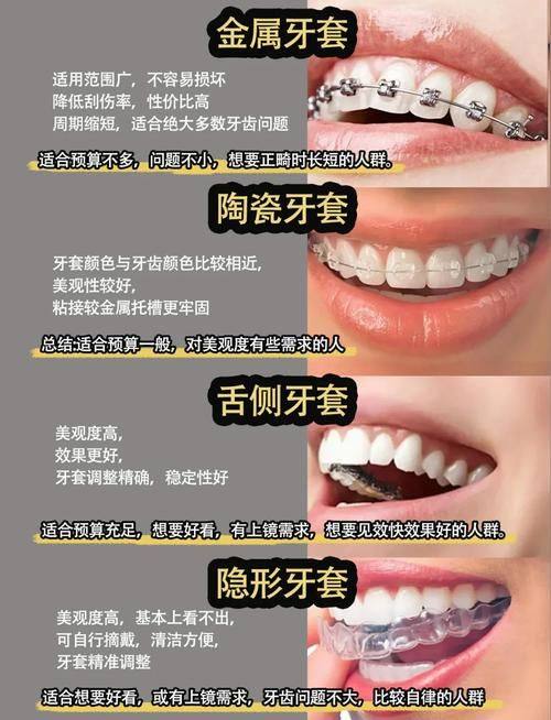 重庆雅乐口腔特色项目及技术优势