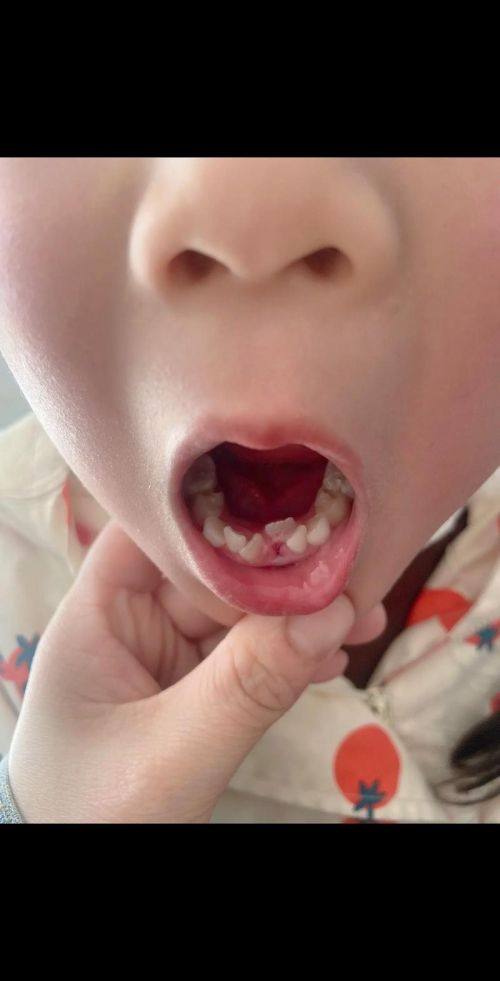 重庆雅乐口腔详细的预约挂号方式及流程