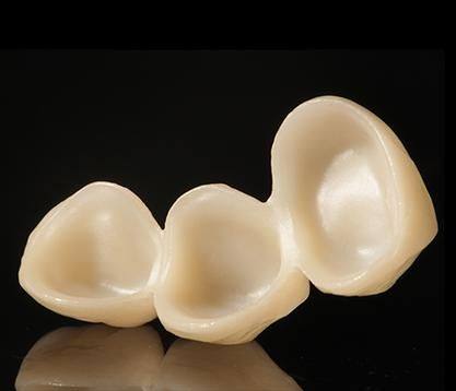 重庆雅乐口腔收费价格表/收费标准