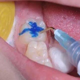 北京兴璜卓马口腔门诊部收费价格表/收费标准