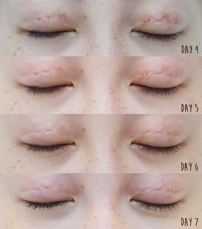 沈阳汇禾医疗美容门诊部是正规医院吗?