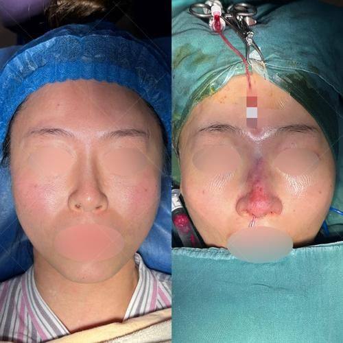 沈阳汇禾医疗美容门诊部特色项目及技术优势