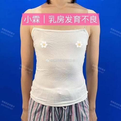 济南美呗整形医院详细的预约挂号方式及流程