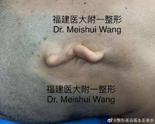 广州尚佳逸韩义整形医疗美容真人口碑评价怎么样?