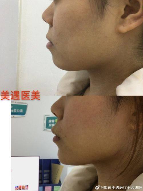 沈阳汇禾医疗美容门诊部详细的预约挂号方式及流程