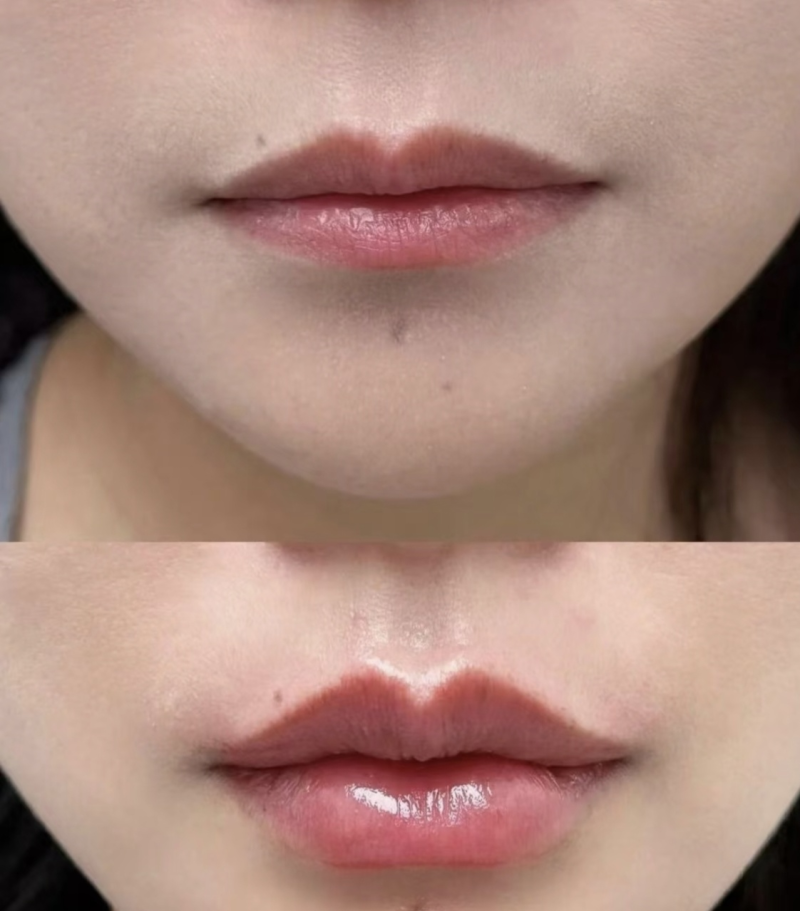 济南美呗整形医院真人口碑评价怎么样?