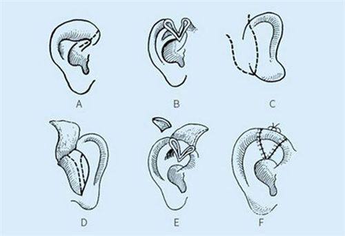 毕节发博士植发医院真人口碑评价怎么样?