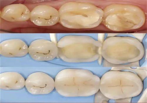 大同韩丽娜口腔是正规医院吗?