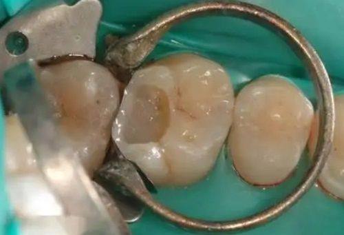 浙江金华东阳贝圣美口腔地址电话营业时间