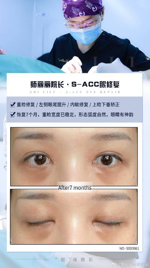 成都美极整形美容医院详细的预约挂号方式及流程