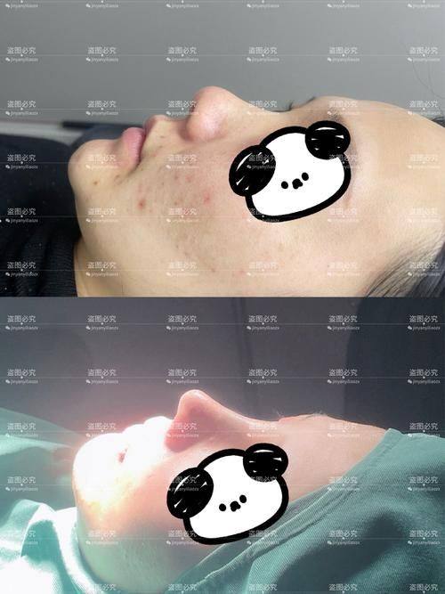 成都美极整形美容医院特色项目及技术优势