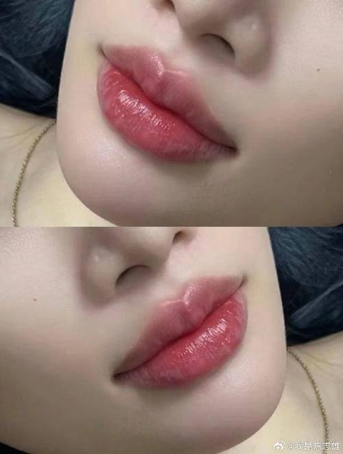 营口康艺医院美容整形诊所详细的预约挂号方式及流程