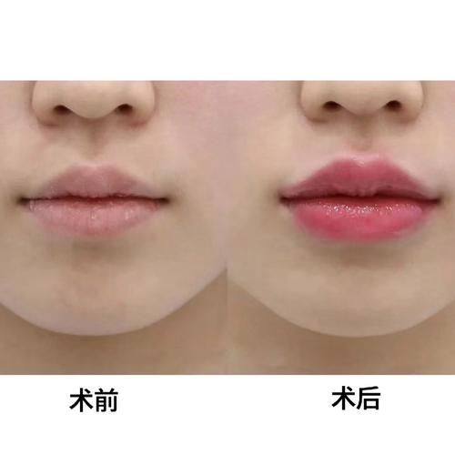 洛阳谢景良医疗美容诊所详细的预约挂号方式及流程