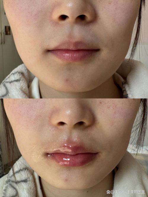 洛阳谢景良医疗美容诊所收费价格表/收费标准