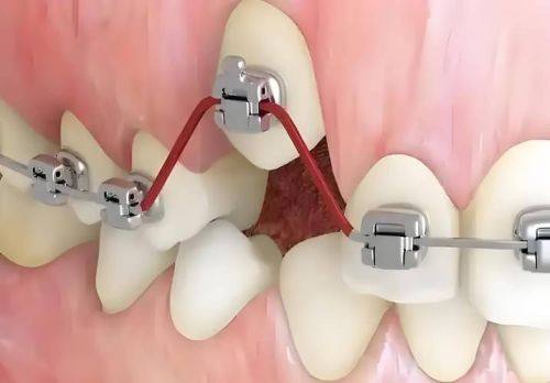 佛山南海思微瑞华口腔门诊部特色项目及技术优势