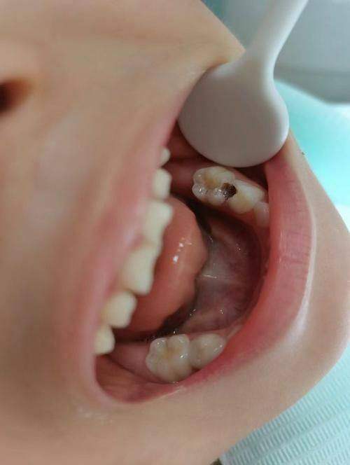 浙江金华东阳贝圣美口腔特色项目及技术优势