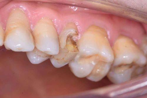 上海艾丽特口腔门诊部真人口碑评价怎么样?