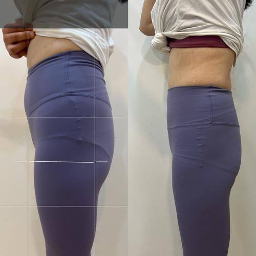 营口康艺医院美容整形诊所是正规医院吗?