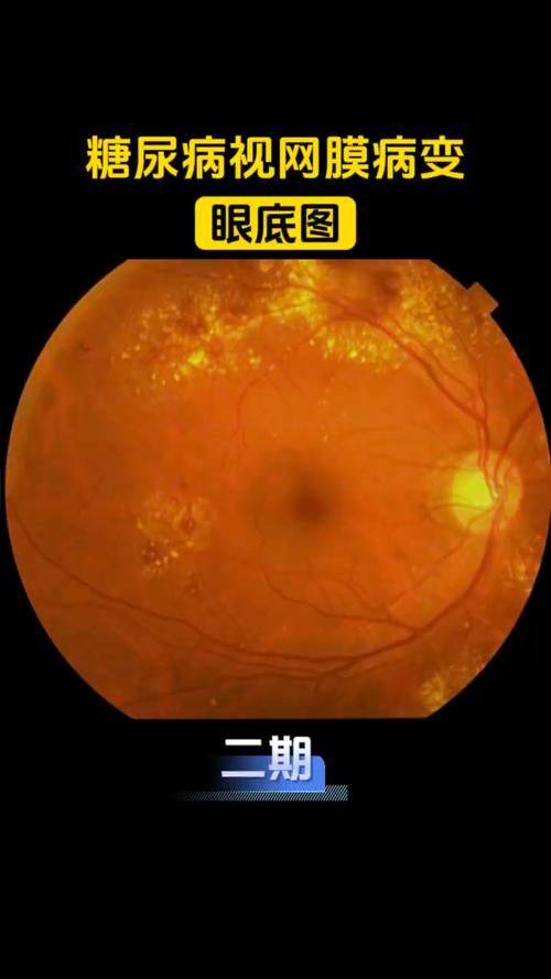 抚顺眼病医院地址电话营业时间