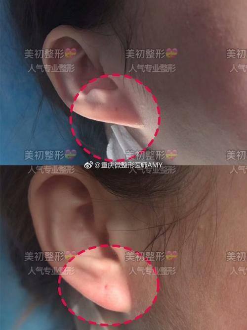 厦门樱基医疗美容诊所详细的预约挂号方式及流程