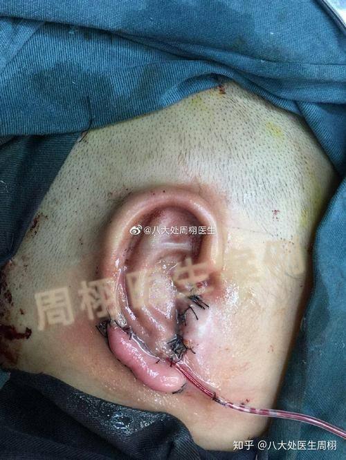 厦门樱基医疗美容诊所收费价格表/收费标准