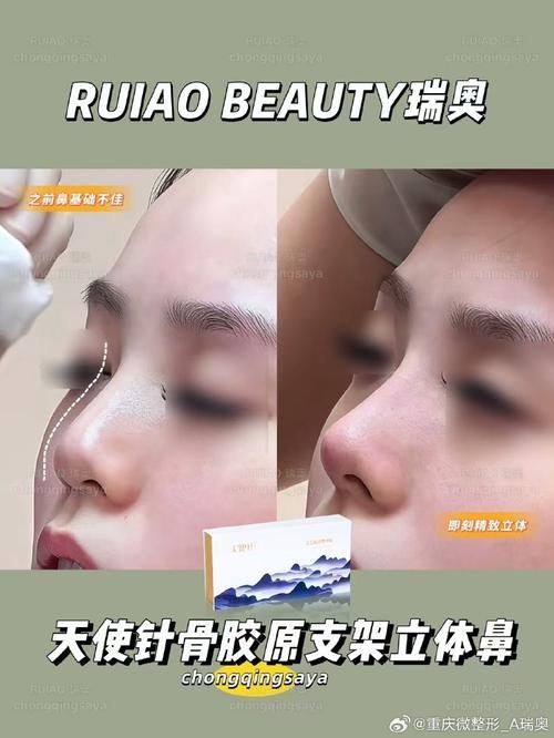 鸡西王医生整形外科门诊部真人口碑评价怎么样?