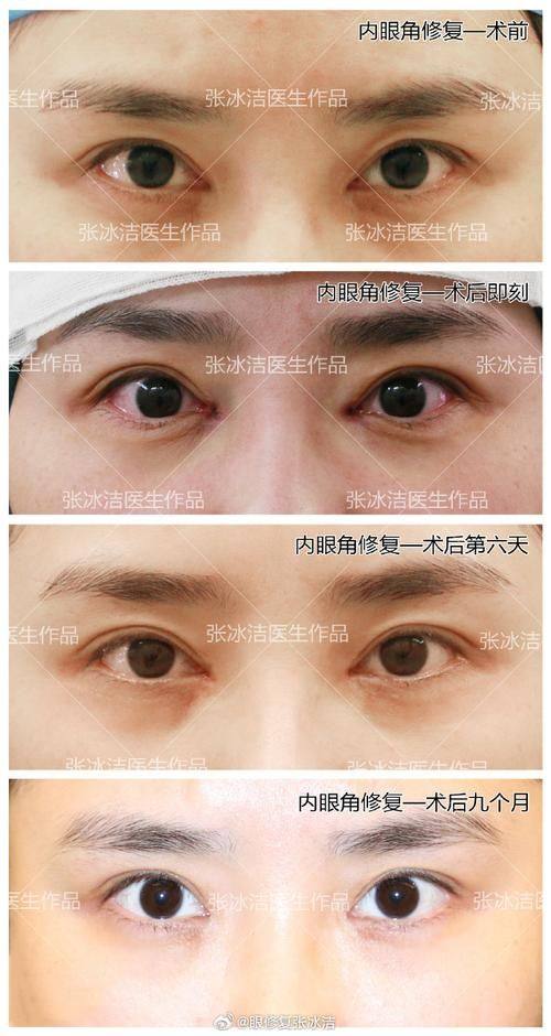 十堰中爱铭医整形医院真人口碑评价怎么样？