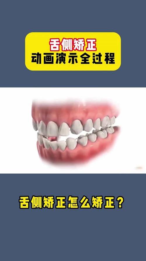 深圳合诺口腔大冲店特色项目及技术优势