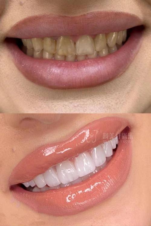 上海艾丽特口腔门诊部详细的预约挂号方式及流程