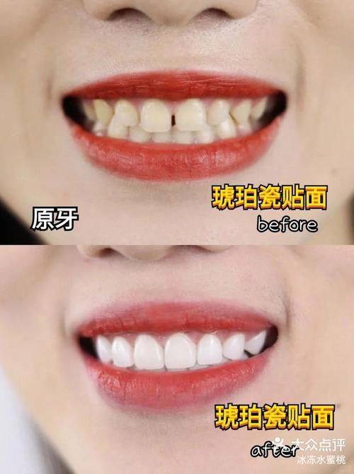 上海艾丽特口腔门诊部地址电话营业时间