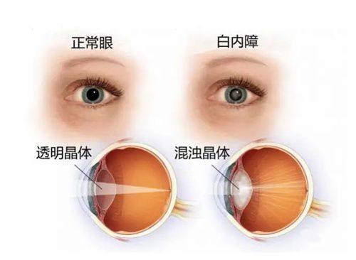 广州番禺眼管家眼科门诊部真人口碑评价怎么样？