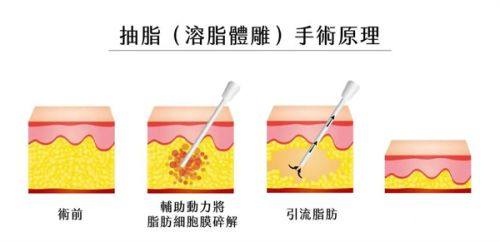 内蒙古姳媛医疗美容诊所是正规医院吗?