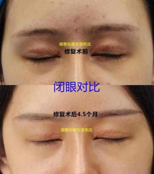 佛山美莱医疗美容整形医院特色项目及技术优势