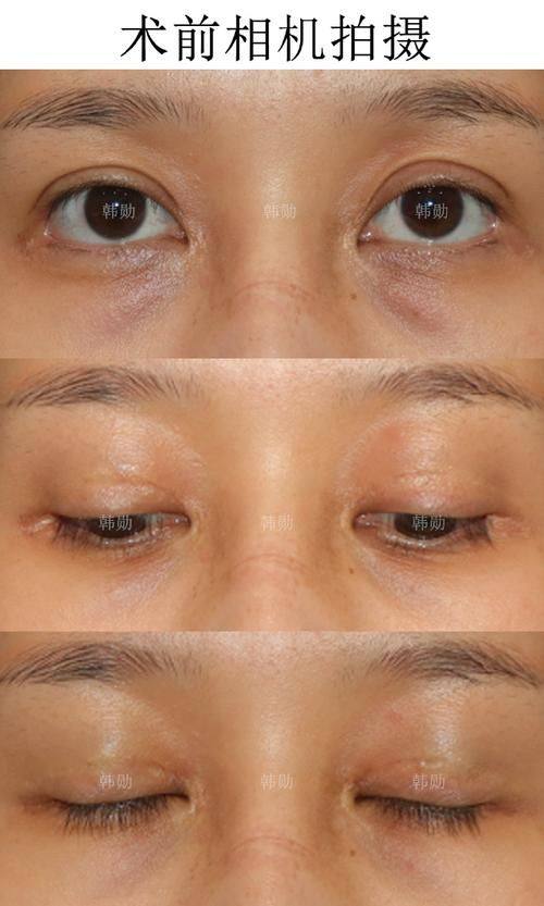 西安丽星美嘉儿医疗美容门诊部真人口碑评价怎么样?