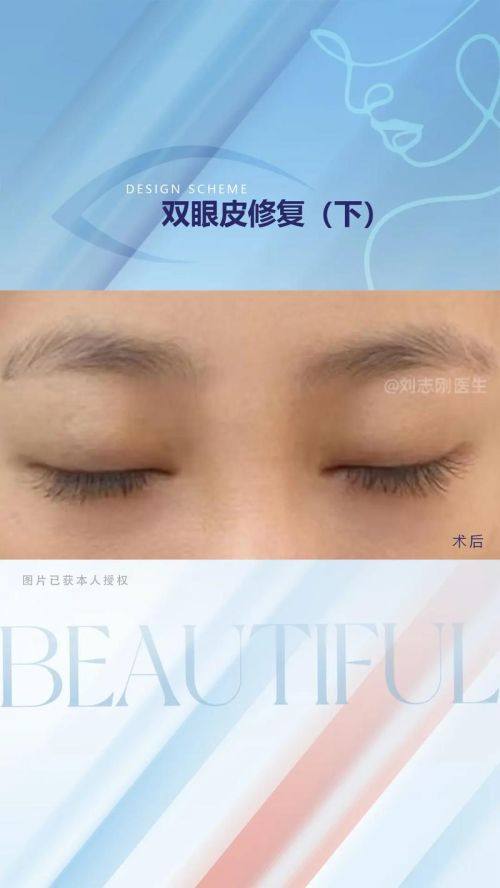 佛山美莱医疗美容整形医院地址电话营业时间